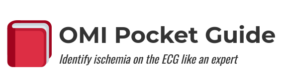 Capçalera de la webapp omiguide. A l'esquerra un dibuix d'un llibre amb la tapa vermella. A la dreta el títol: "OMI Pocket Guide", i a sota el subtítol: "Identify ischemia on the ECG like an expert"