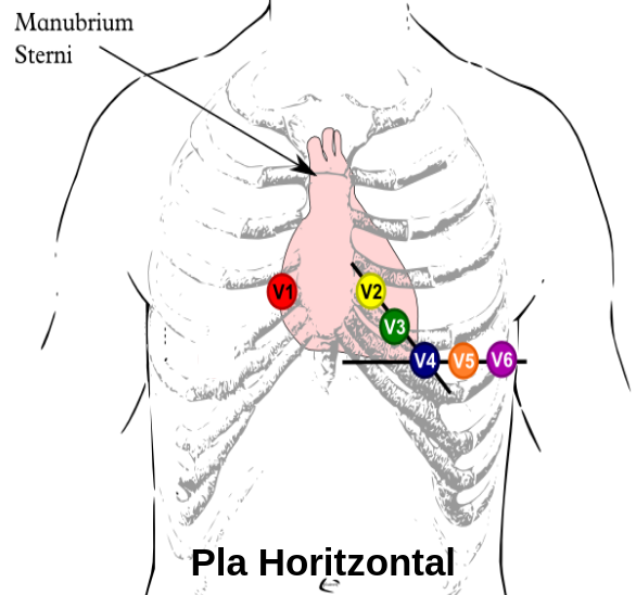 Episodi 36: Com fer correctament l’electrocardiograma