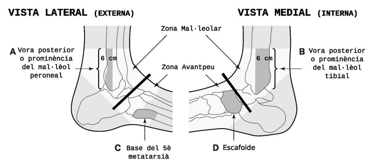 Radiografia en lesions traumàtiques agudes de turmell-avantpeu i genoll
