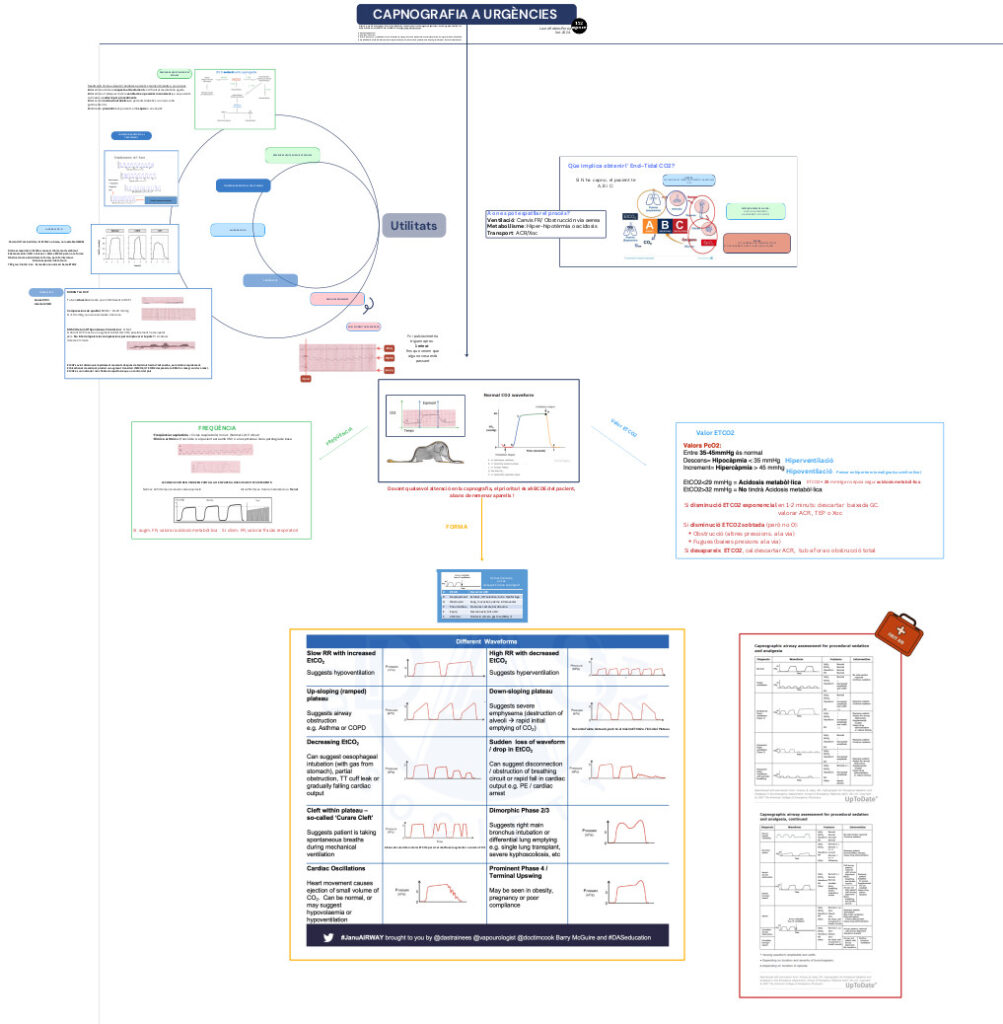 Infografia resum de capnografia