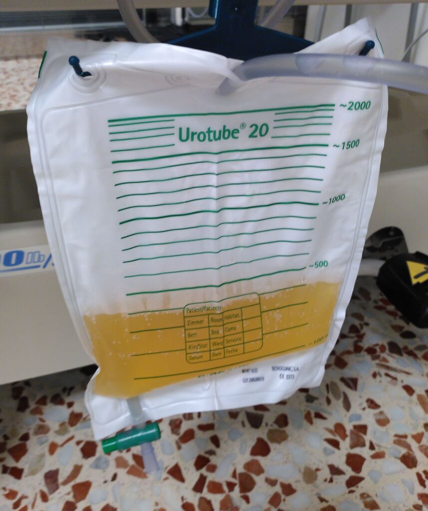 Bossa d'orina penjada del lateral d'una llitera