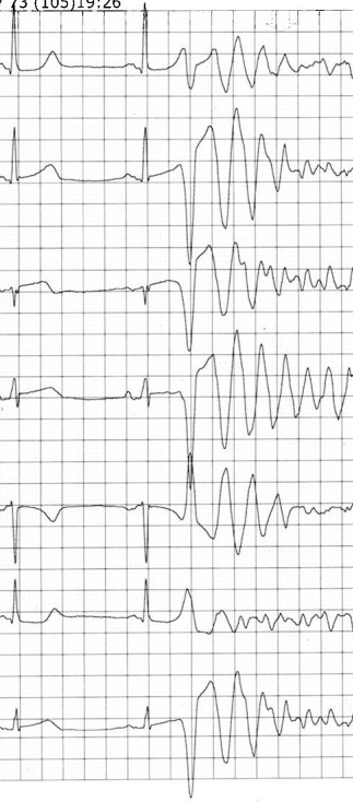 Episodi 52: R sobre T