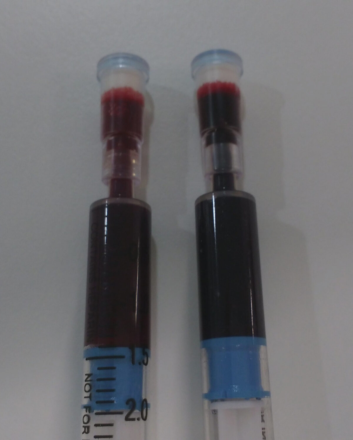 No sol·licitar sistemàticament una gasometria arterial per avaluar hipercàpnia en pacients amb dispnea aguda